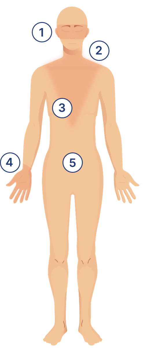 managedermatomyositis.com, body-different-breakout-points-illustration