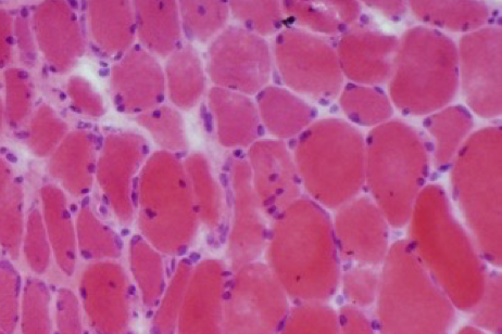 managedermatomyositis.com, close-up-scientific-image