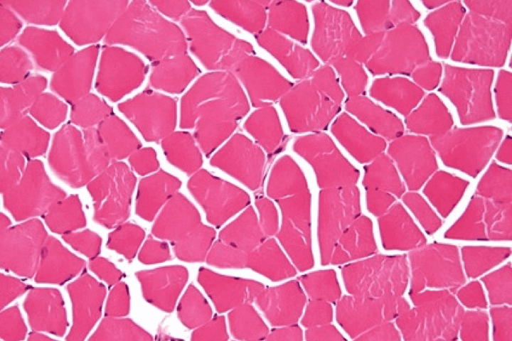 managedermatomyositis.com, close-up-muscle-scientific